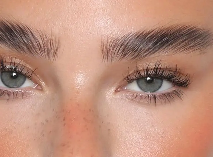 lifting de cejas